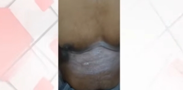 5-Year-Old Man Suffers Sunstroke While Traveling in Car in Kunnamkulam