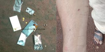NEW MOBILE PHONE BURST AND INJURED