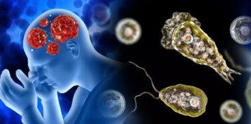 Amoebic Meningitis