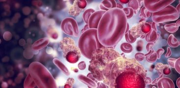 Leukemia is on the rise globally; Reports