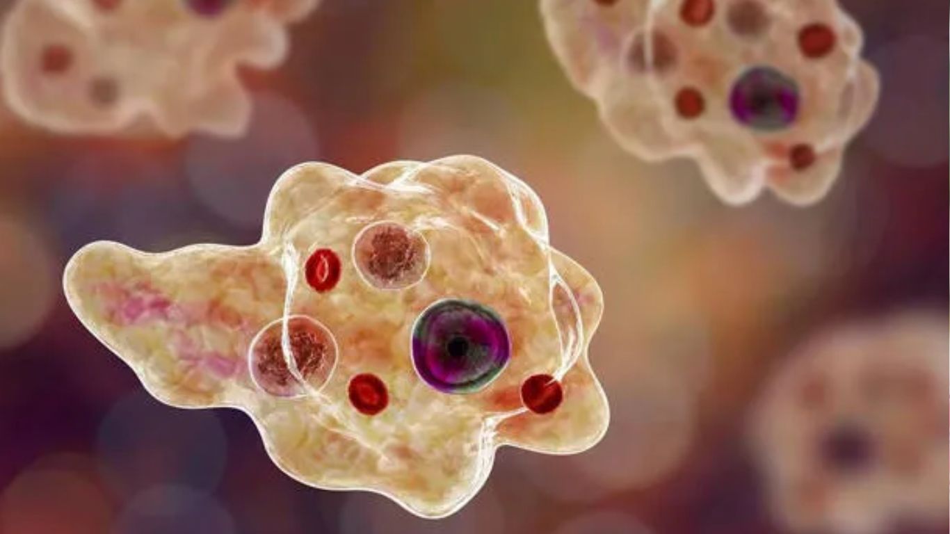 Amoebic encephalitis