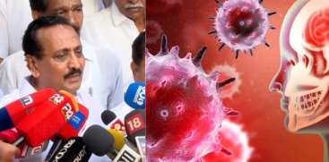 Amoebic Meningoencephalitis