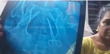Woman Admitted to Amrita Hospital Kochi After Scissors Found in Abdomen