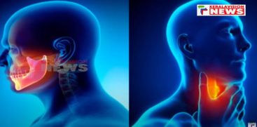 Study that 20 percent of cancer cases in India are among young people below 40 years of age