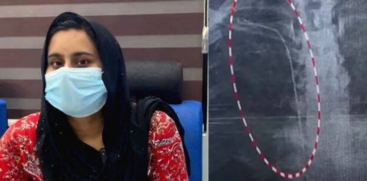 Kerala Medical Board to Meet on Guide Wire Stuck in Patient's Chest at Thiruvananthapuram Hospital