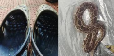 snake bite