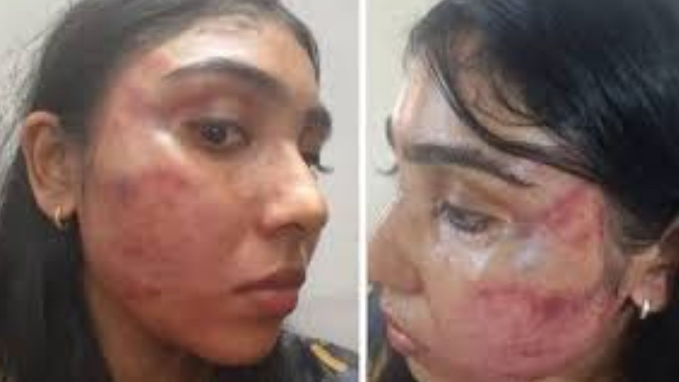 Junior lawyer assault case