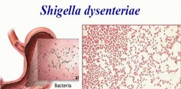 Wayanad Shigella Update