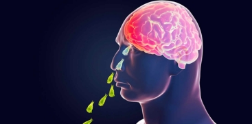 Amebic Meningoencephalitis