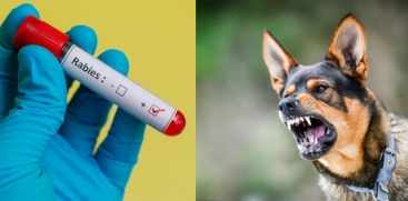 Rabies Diagnosed in 7-Year-Old Girl