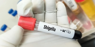 New Shigella Infections Reported