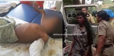 Child's Mother And Male Friend Have Been Arrested In Connection With The Brutal Beating