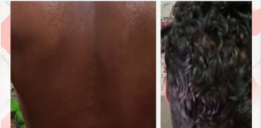 Adoor Custodial Assault