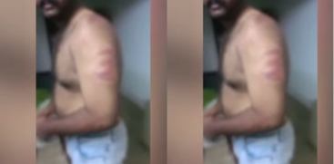 Police Brutality Complaint Filed by Youth