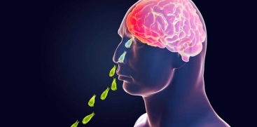 Amoebic Meningitis