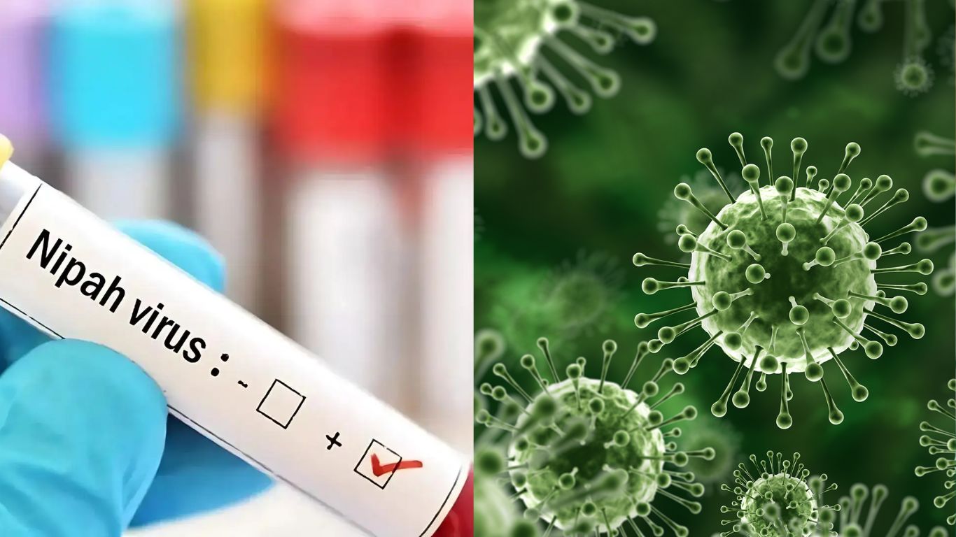nipah virus