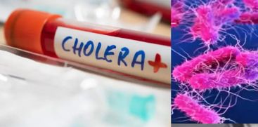 cholera