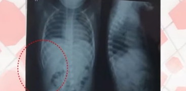 Official Report Finds No Medical Negligence in Recent Treatment Case