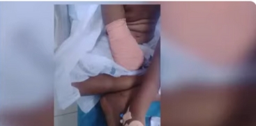 2 Doctors Suspended After 9-Year-Old Girl's Hand Amputated